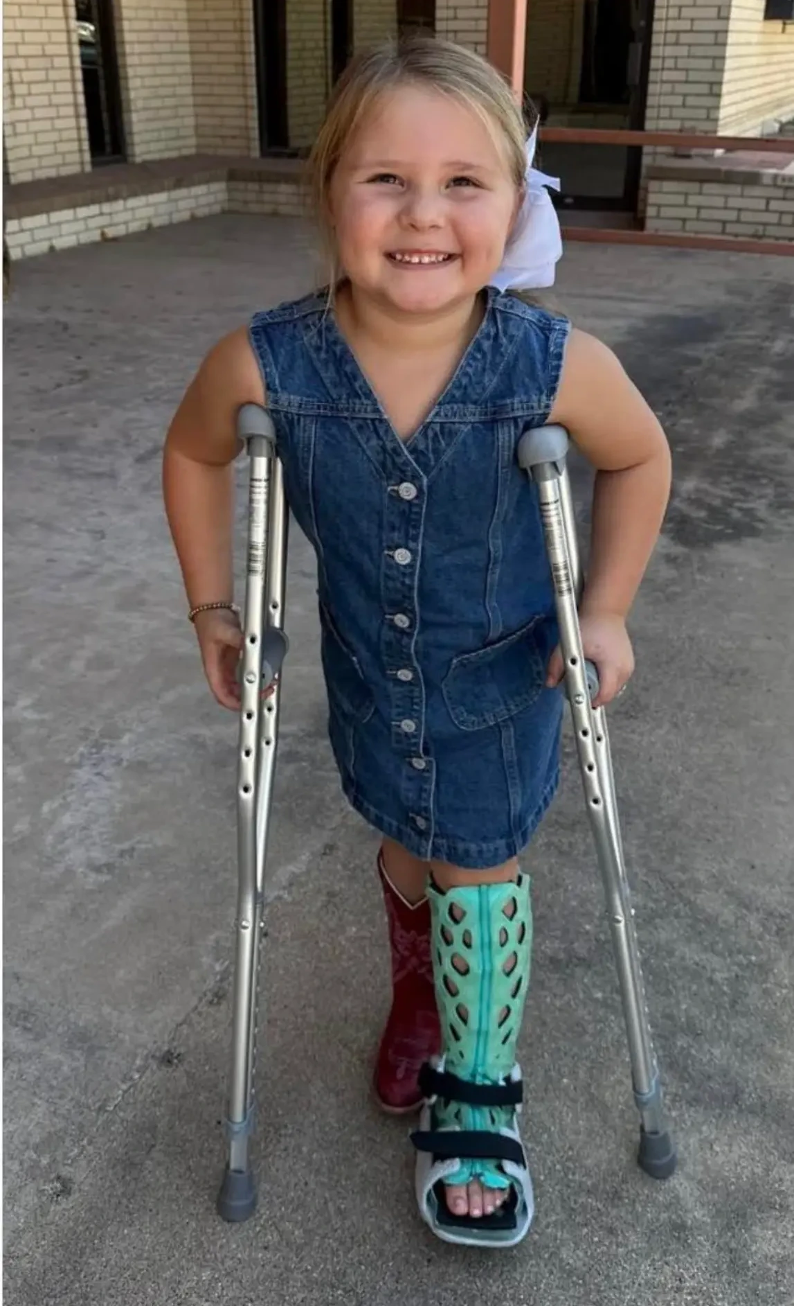 A child on crutches wearing a green FlexiOH leg cast