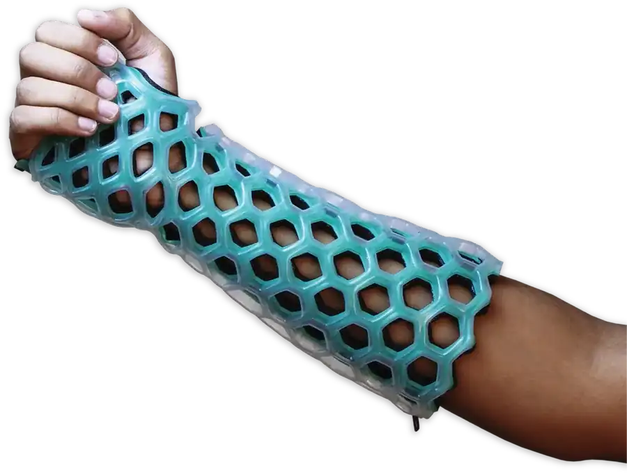 FlexiOH short arm cast with open ventilation windows