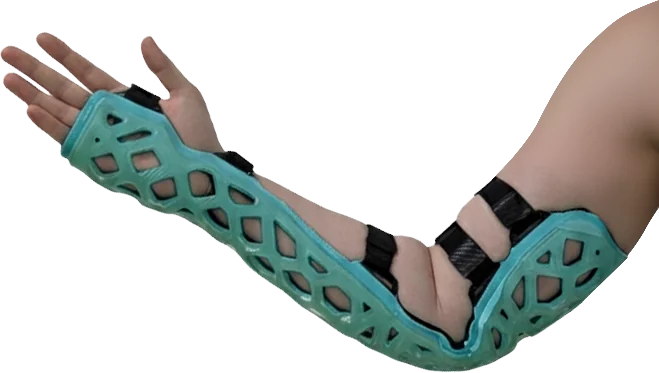 FlexiOH splint configuration held with straps on a forearm
