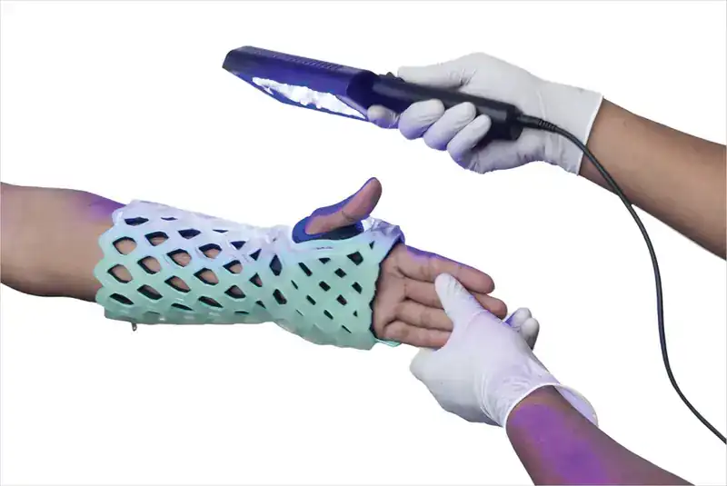 RizyCure blue-light device curing a FlexiOH cast on a wrist